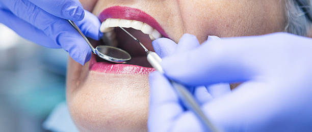Best Emergency Root Canal Treatment in Bergenfield, NJ